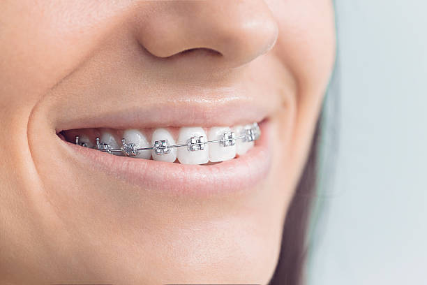 Best Dental Fillings (Composite and Amalgam)  in Hidden Hills, CA